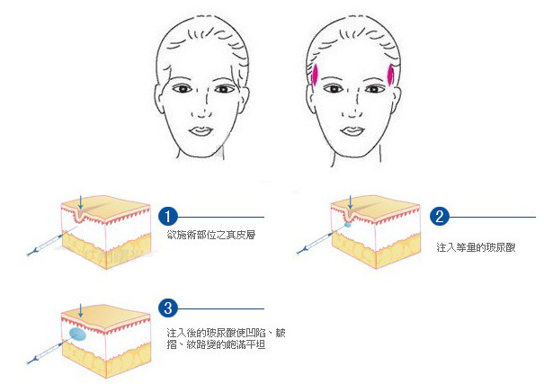 20150429143539701.jpg