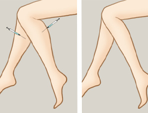 瘦小腿肌肉的方法女 20150512083513721.jpg