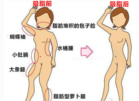 20160402083513206.png